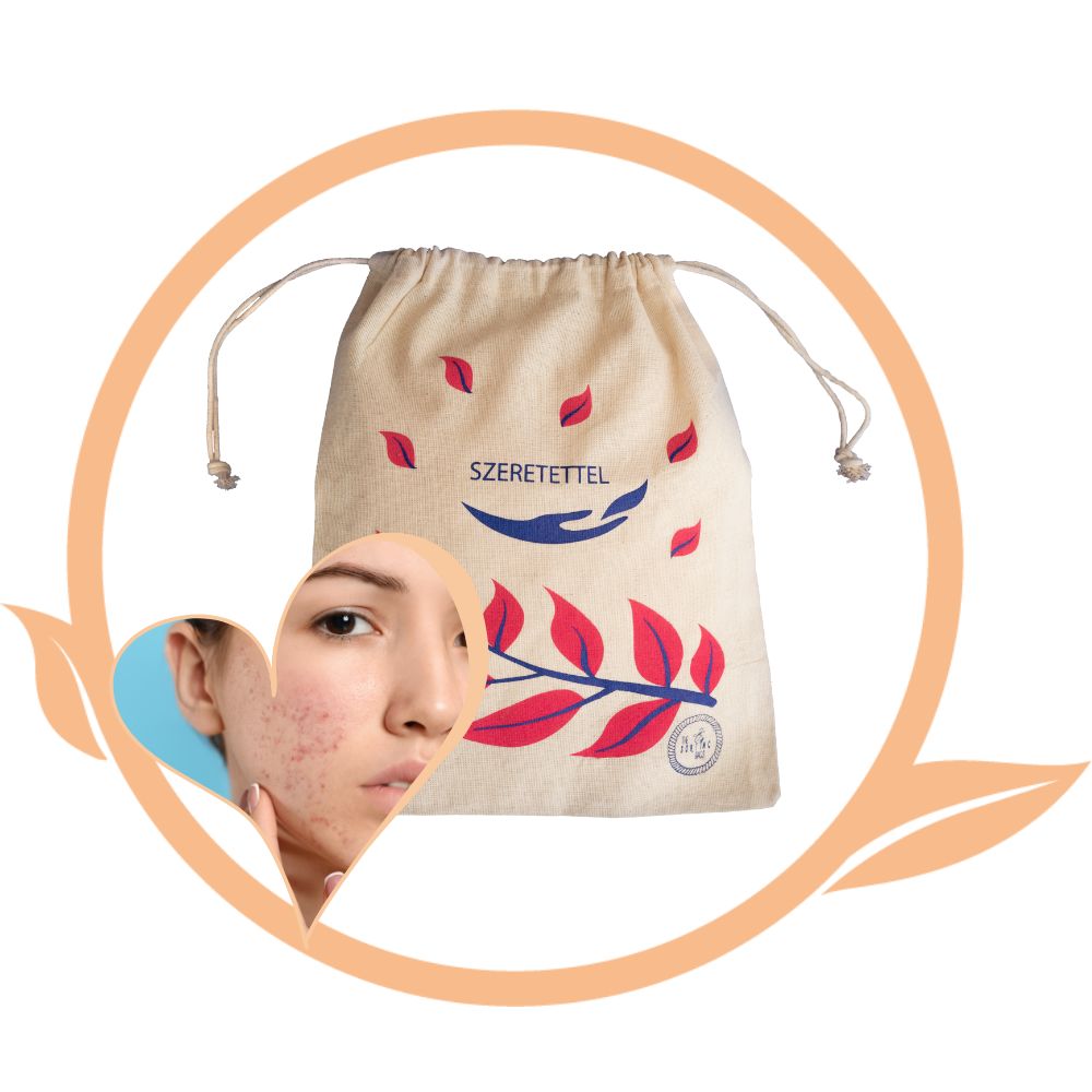 Ekcémaharcos arc- és testápoló csomag